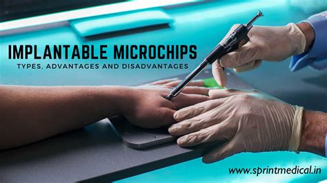 man gets rfid chip implant|Microchips in humans: consumer.